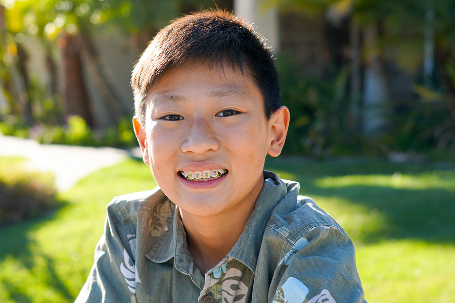 Metal Braces for Kids: A Reliable Solution for a Perfect Smile